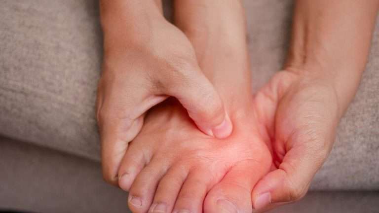 Hammertoe and Bunions